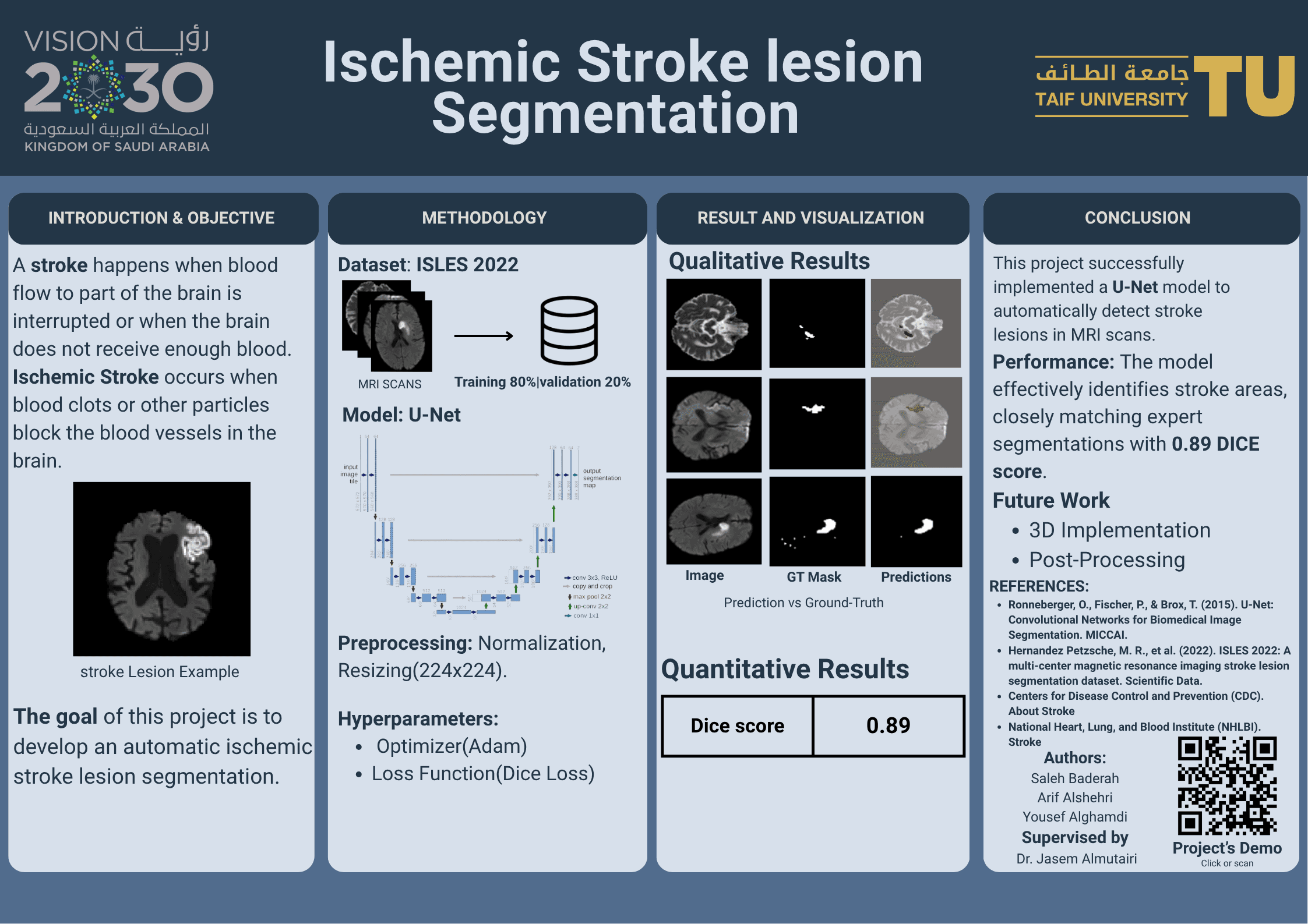 Ischemic stroke lesion segmentation project poster